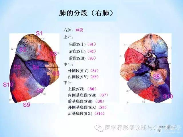 d9.jpg