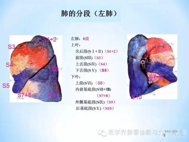 d10.jpg