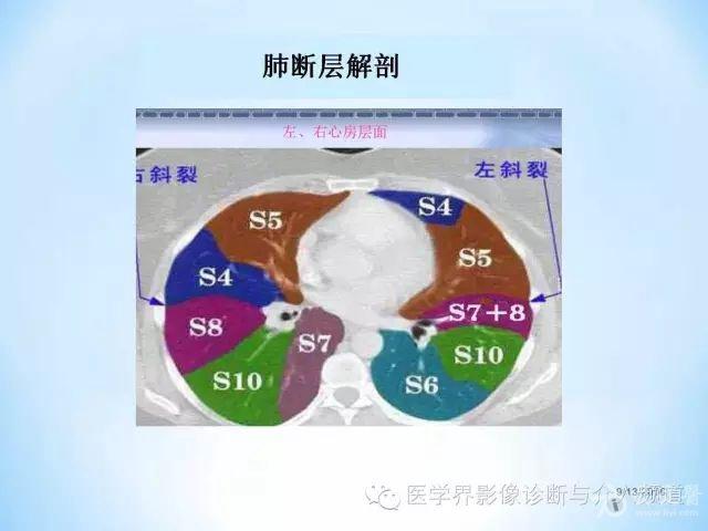 d14.jpg