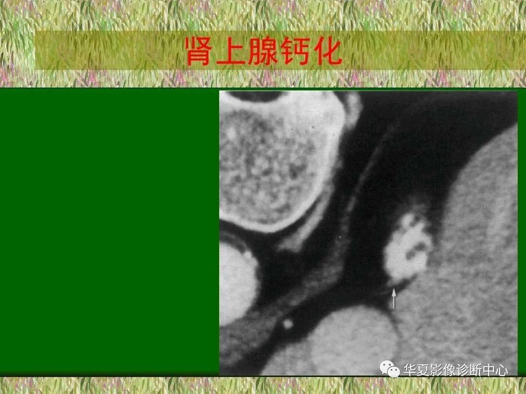 d56.jpg