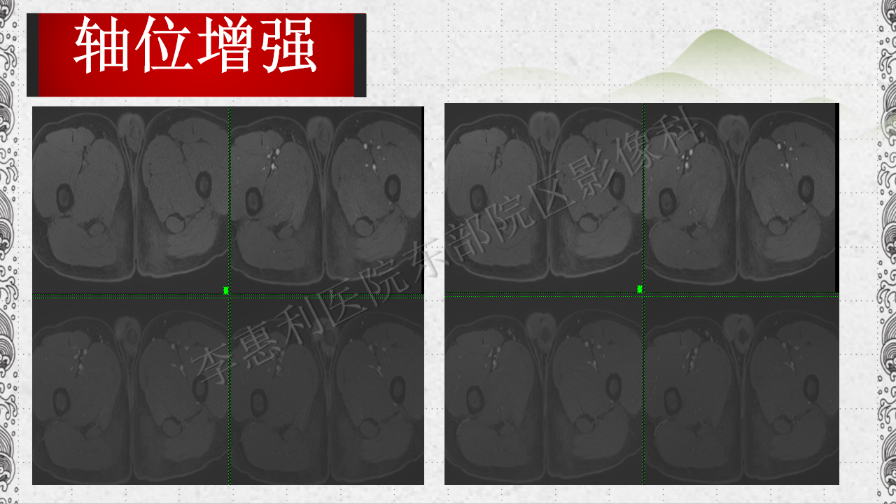 d7.png